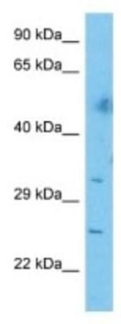 CEP72 Rabbit anti-Human, Polyclonal, Novus Biologicals 100 &mu;g | Buy Online | Novus Biologicals | Fisher Scientific